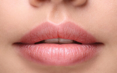 Get “Mistletoe Ready” with Lip Enhancement!