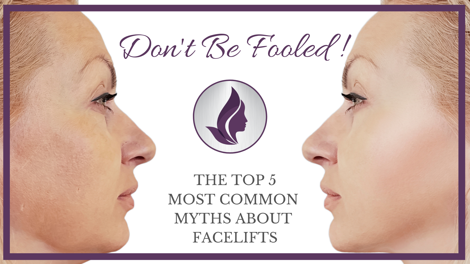 DON’T BE FOOLED! THE TOP 5 MOST COMMON MYTHS ABOUT FACELIFTS