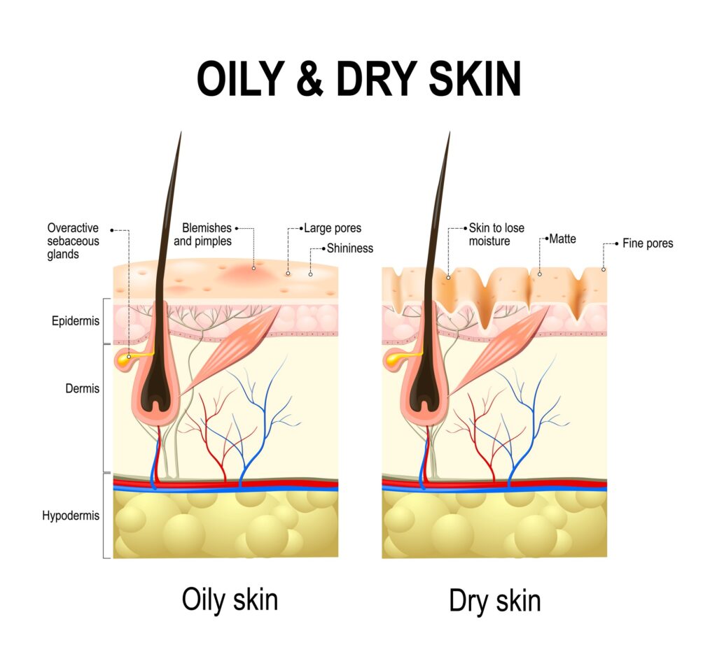 Oily and Dry skin illustration