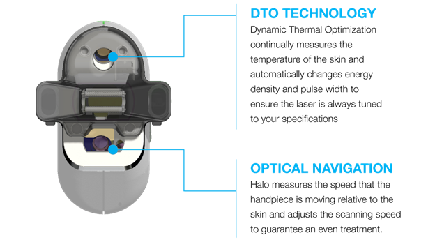 Halo device diagram