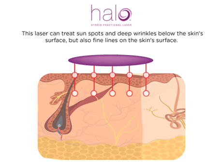 Halo technology infographics