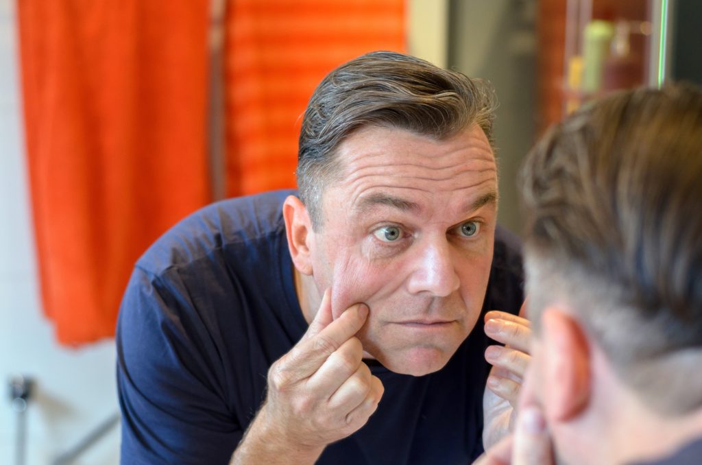 facelifts are also for men